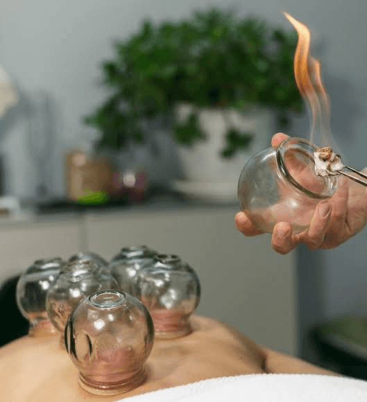 Cupping Dos