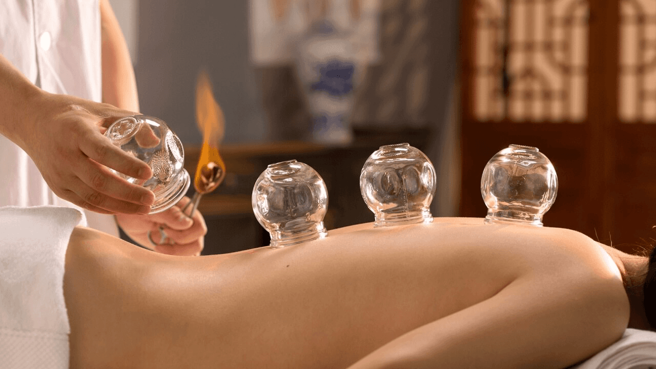 Cupping Complet